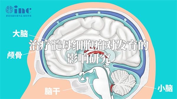 治疗髓母细胞瘤对发育的影响研究