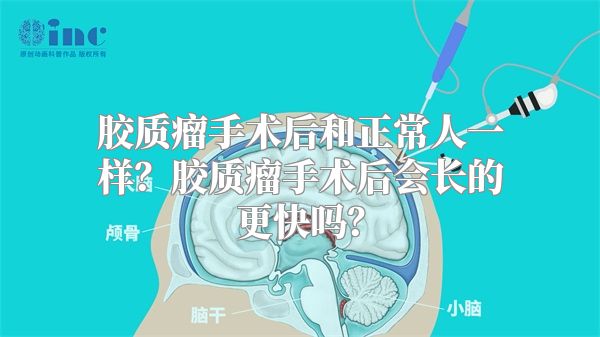 胶质瘤手术后和正常人一样？胶质瘤手术后会长的更快吗？