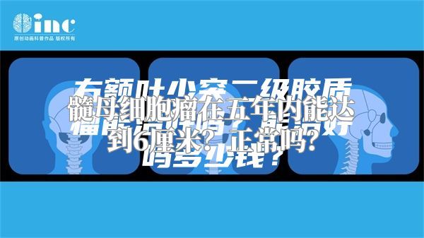 髓母细胞瘤在五年内能达到6厘米？正常吗？