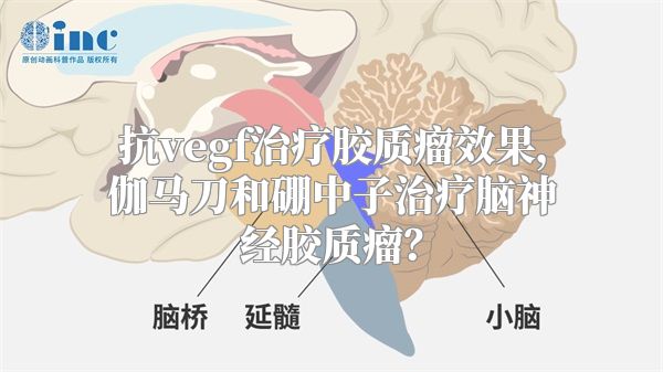 抗vegf治疗胶质瘤效果，伽马刀和硼中子治疗脑神经胶质瘤？