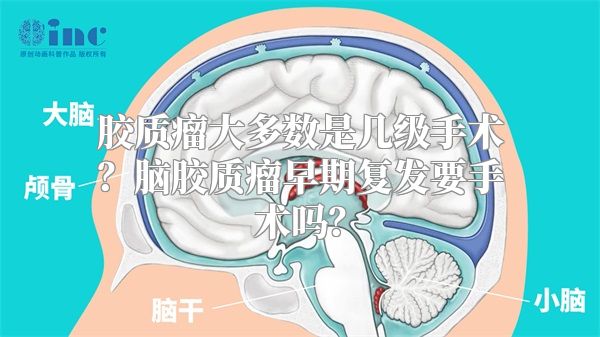 胶质瘤大多数是几级手术？脑胶质瘤早期复发要手术吗？