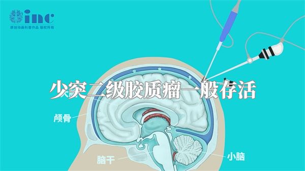 少突二级胶质瘤一般存活