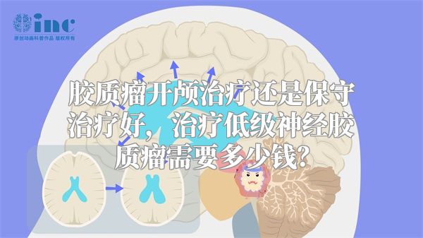 胶质瘤开颅治疗还是保守治疗好，治疗低级神经胶质瘤需要多少钱？