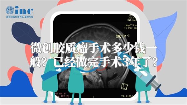 微创胶质瘤手术多少钱一般？已经做完手术3年了？