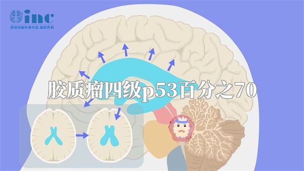 胶质瘤四级p53百分之70