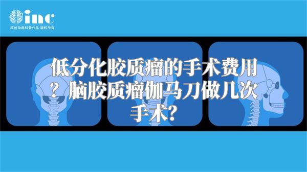 低分化胶质瘤的手术费用？脑胶质瘤伽马刀做几次手术？