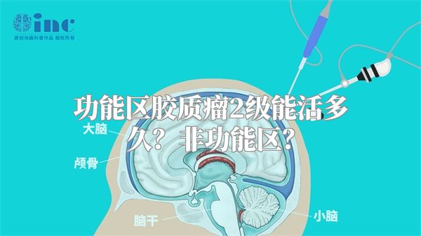 功能区胶质瘤2级能活多久？非功能区？