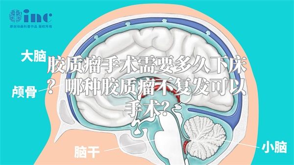 胶质瘤手术需要多久下床？哪种胶质瘤不复发可以手术？