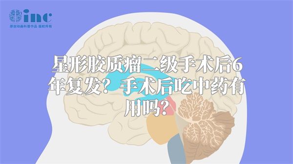 星形胶质瘤二级手术后6年复发？手术后吃中药有用吗？