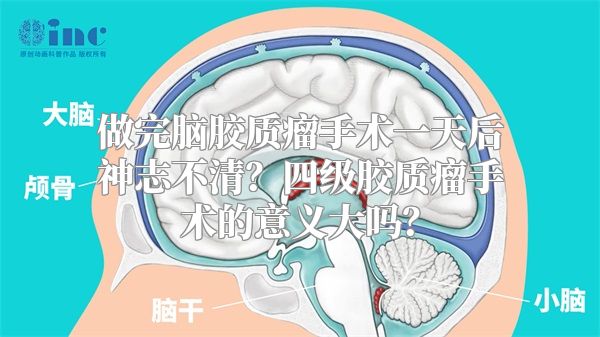 做完脑胶质瘤手术一天后神志不清？四级胶质瘤手术的意义大吗？