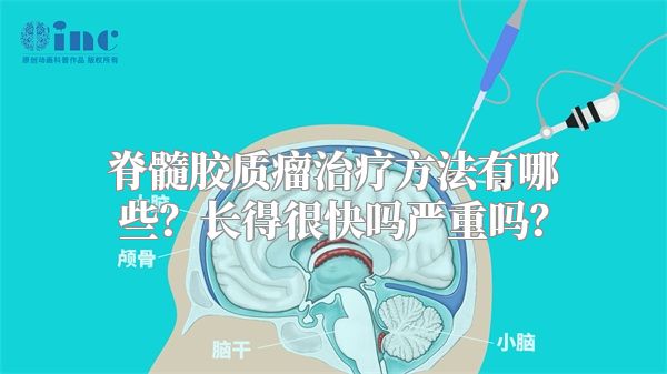 脊髓胶质瘤治疗方法有哪些？长得很快吗严重吗？