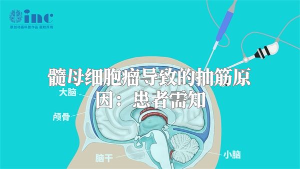 髓母细胞瘤导致的抽筋原因：患者需知