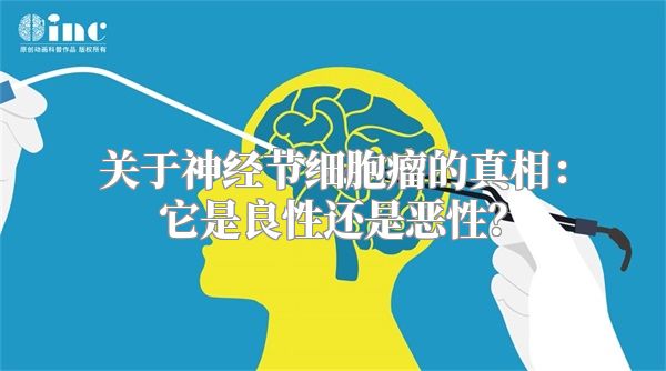 关于神经节细胞瘤的真相：它是良性还是恶性？