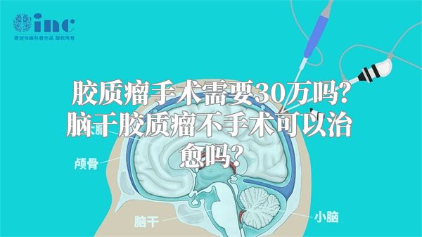 胶质瘤手术需要30万吗？脑干胶质瘤不手术可以治愈吗？