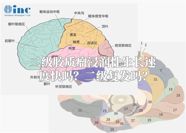 二级胶质瘤浸润性生长速度快吗？二级复发吗？