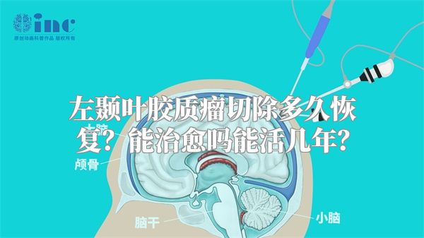 左颞叶胶质瘤切除多久恢复？能治愈吗能活几年？