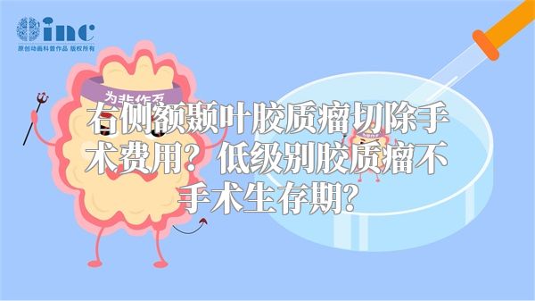 右侧额颞叶胶质瘤切除手术费用？低级别胶质瘤不手术生存期？