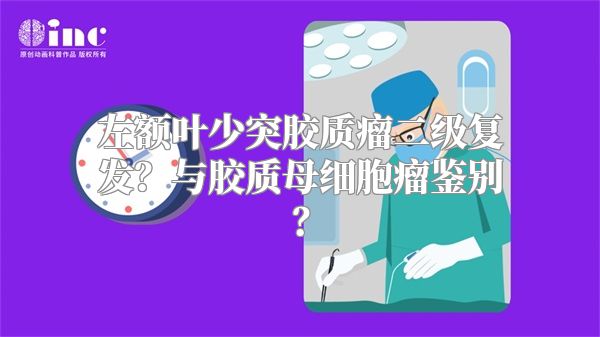 左额叶少突胶质瘤二级复发？与胶质母细胞瘤鉴别？