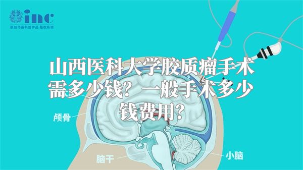 山西医科大学胶质瘤手术需多少钱？一般手术多少钱费用？