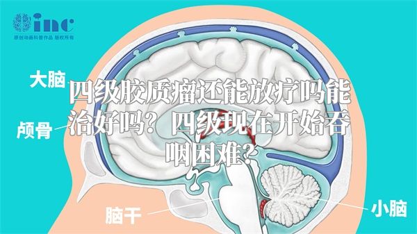 四级胶质瘤还能放疗吗能治好吗？四级现在开始吞咽困难？