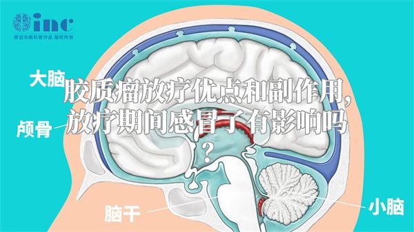 胶质瘤放疗优点和副作用，放疗期间感冒了有影响吗？