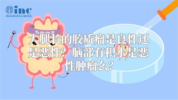 大腿长的胶质瘤是良性还是恶性？脑部有积水是恶性肿瘤么？