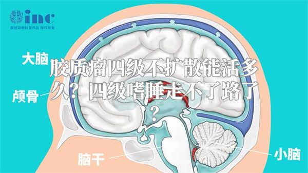 胶质瘤四级不扩散能活多久？四级嗜睡走不了路了？