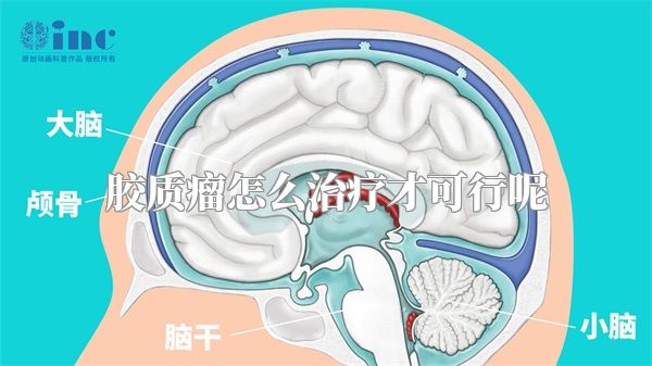 胶质瘤怎么治疗才可行呢