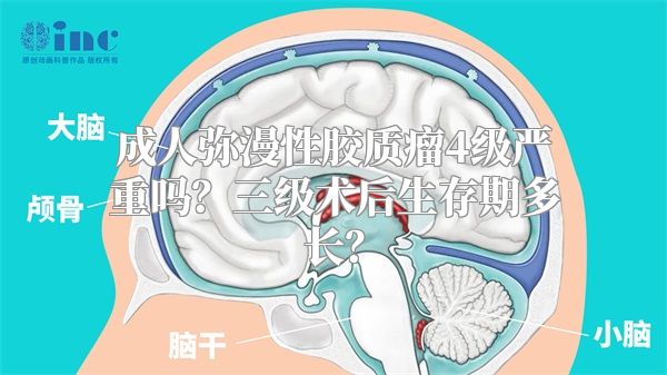 成人弥漫性胶质瘤4级严重吗？三级术后生存期多长？