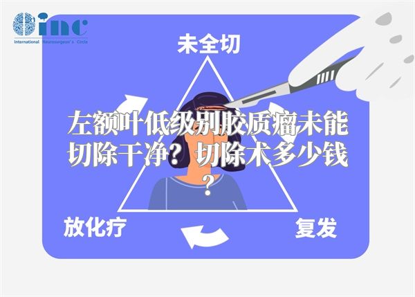 左额叶低级别胶质瘤未能切除干净？切除术多少钱？