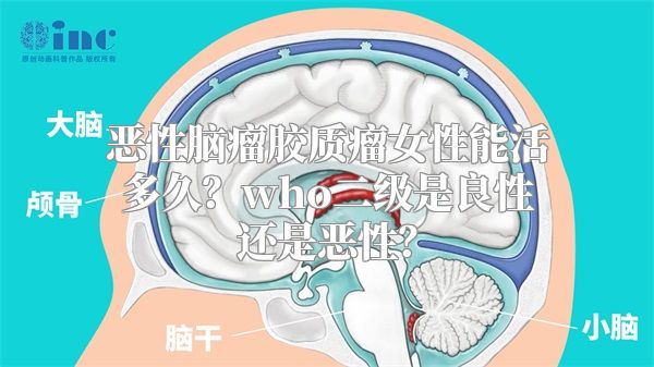 恶性脑瘤胶质瘤女性能活多久？who二级是良性还是恶性？