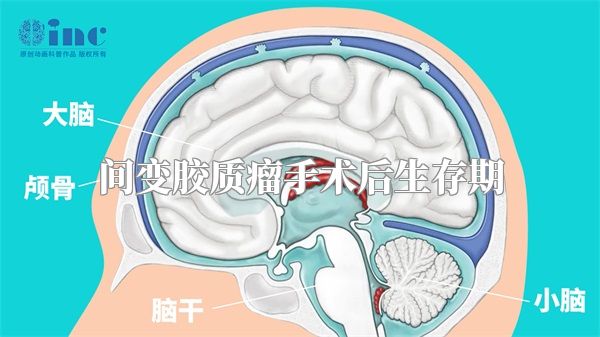 间变胶质瘤手术后生存期