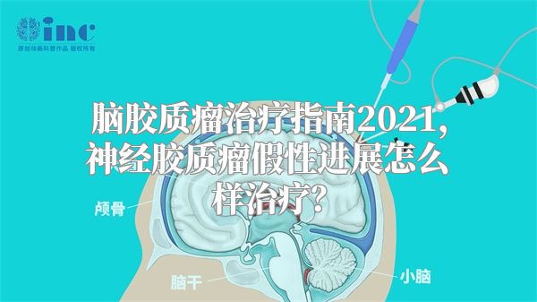 脑胶质瘤治疗指南2021，神经胶质瘤假性进展怎么样治疗？