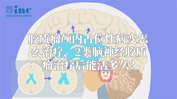 胶质瘤颅内占位性病变怎么治疗，2类脑神经胶质瘤治疗后能活多久？