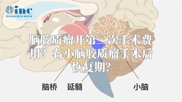 脑胶质瘤开第二次手术费用？右小脑胶质瘤手术后恢复期？