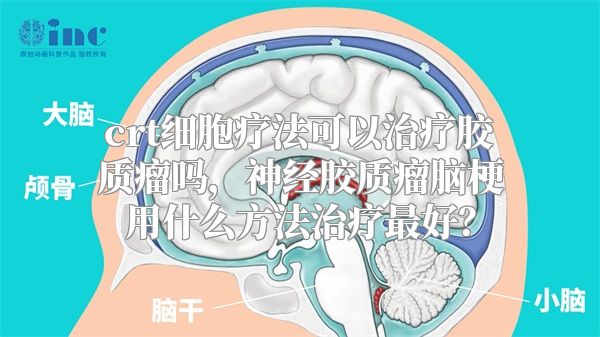 crt细胞疗法可以治疗胶质瘤吗，神经胶质瘤脑梗用什么方法治疗最好？