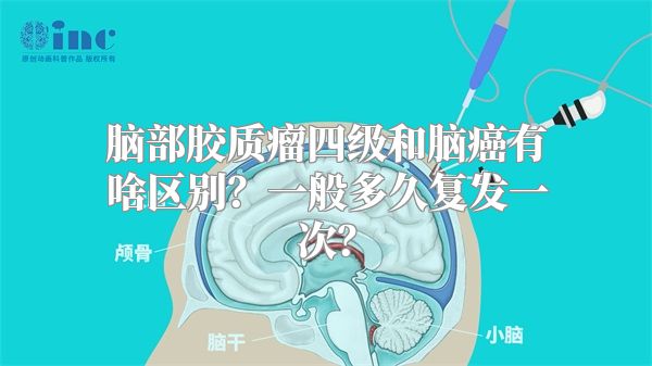 脑部胶质瘤四级和脑癌有啥区别？一般多久复发一次？