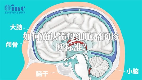 如何确认髓母细胞瘤的诊断标准？