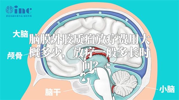 脑膜外胶质瘤放疗费用大概多少，放疗一般多长时间？