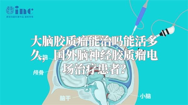 大脑胶质瘤能治吗能活多久，国外脑神经胶质瘤电场治疗患者？