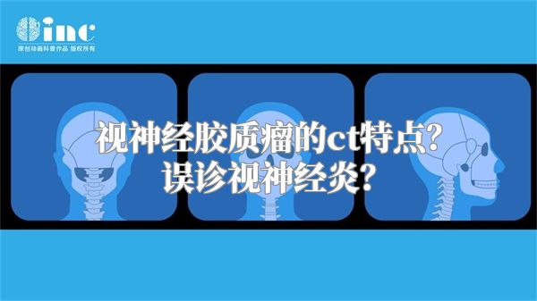 视神经胶质瘤的ct特点？误诊视神经炎？