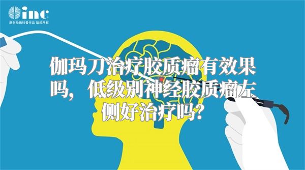 伽玛刀治疗胶质瘤有效果吗，低级别神经胶质瘤左侧好治疗吗？