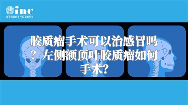 胶质瘤手术可以治感冒吗？左侧额顶叶胶质瘤如何手术？