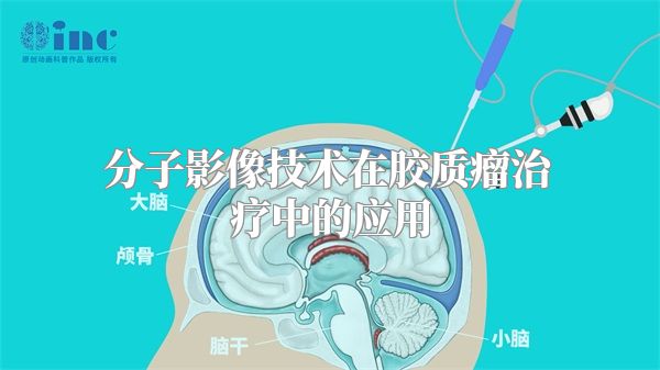 分子影像技术在胶质瘤治疗中的应用