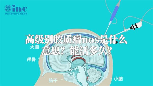 高级别胶质瘤nos是什么意思？能活多久？