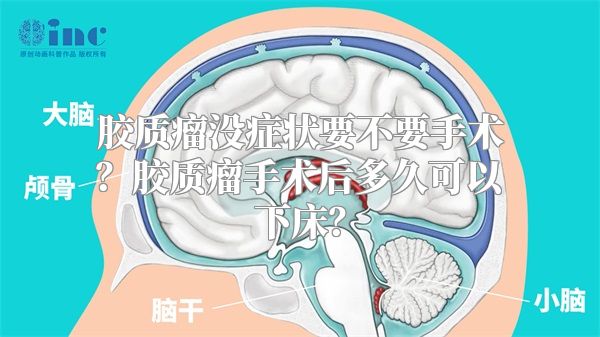 胶质瘤没症状要不要手术？胶质瘤手术后多久可以下床？