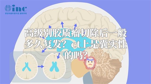 高级别胶质瘤切除后一般多久复发？ct上是囊实性的吗？