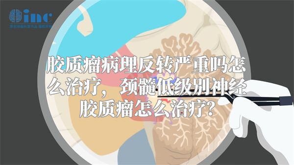 胶质瘤病理反转严重吗怎么治疗，颈髓低级别神经胶质瘤怎么治疗？