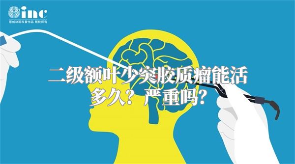 二级额叶少突胶质瘤能活多久？严重吗？