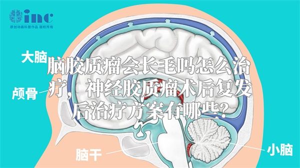 脑胶质瘤会长毛吗怎么治疗，神经胶质瘤术后复发后治疗方案有哪些？